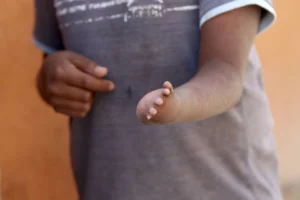 alta-prevalencia-de-intoxicacion-por-plomo-sobre-todo-en-ninos_aac318b3-39ed-4b1f-877d-8143e55dfcaa_medialjnimgndimage=fullsize